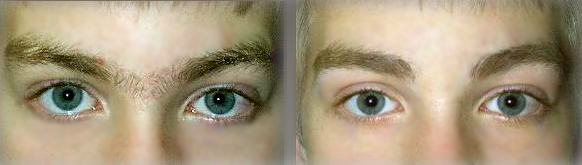 antes e depois sobrancelha masculina